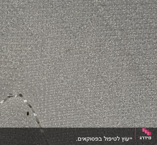 חרק קטן על משטח אפור